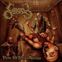 Cranial Osteotomy - Victim of Wicked Sickness (Explicit)