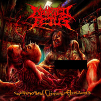 Aborted Fetus - Goresoaked Clinical Accidents (Explicit)