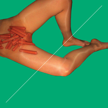 Peaches - Vaginoplasty (Explicit)