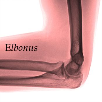 Elbonus