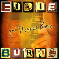 Eddie Burns - 2nd Degree Burns