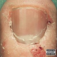 Skrape - New Killer America (Explicit)