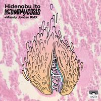 HIDENOBU ITO - Actinomycosis EP