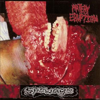 Artery Eruption - Spewage (Explicit)