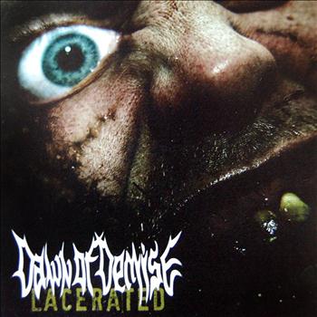 Dawn of Demise - Lacerated