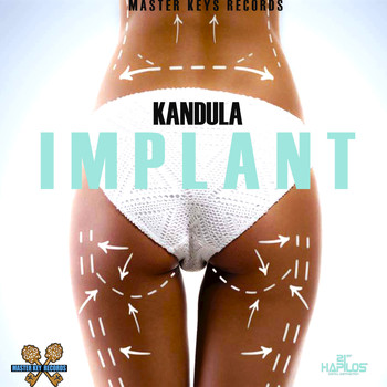 Kandula - Implant - Single