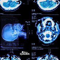 Hedchef - CJAW011: Hedchef