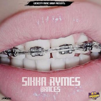 Sikka Rymes - Braces - Single