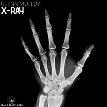 Glenn Molloy - X-Ray