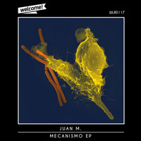 Juan M. - Mecanismo EP