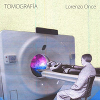 Lorenzo Once - Tomografía