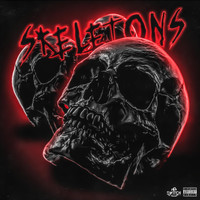 Switch & Moka Only - Skeletons (feat. Moka Only)