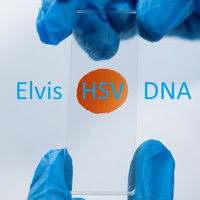 Elvis - HSV DNA