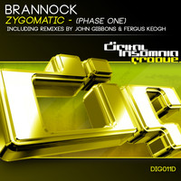 Brannock - Zygomatic (Phase One)