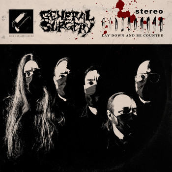General Surgery - Lay Down and Be Counted