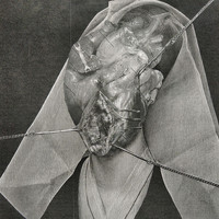 Madrelarva - Sulfurico