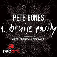 Pete Bones - I Bruise Easily