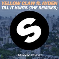 Yellow Claw - Till It Hurts (feat. Ayden) (The Remixes)