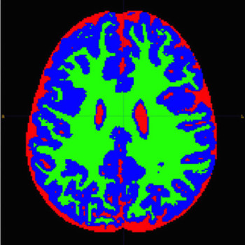 The B Team - B-Sides (Explicit)