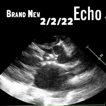 Brand New - Echo (Explicit)