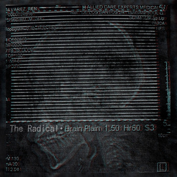 The Radical - Brain Plain
