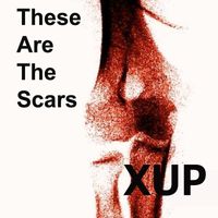 XUP - These Are the Scars (Explicit)