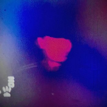 PVTRA - STADIO