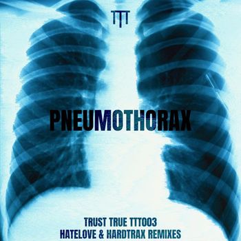 Trust True - Pneumothorax