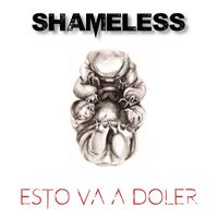 Shameless - Esto Va a Doler