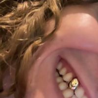 bby - gold teeth & fenty (Explicit)
