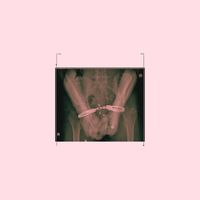 miskin - Hasta (Sped Up) (Explicit)