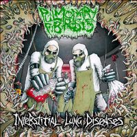 Pulmonary Fibrosis - Interstitial Lung Diseases (Explicit)