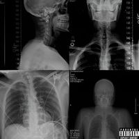 STX - Rotten (Explicit)