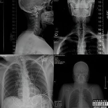 STX - Rotten (Explicit)