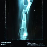 Adrian Wreck - RN141