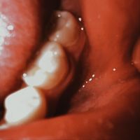 Alex Strong - mouthbreather