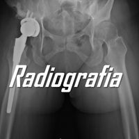 Radiografia - Infernaria