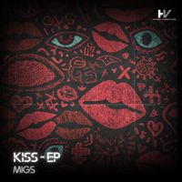 MIGS - Kiss