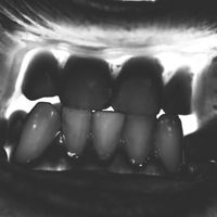 Shail - Zubeidaa (Full Set of Teeth) (Explicit)