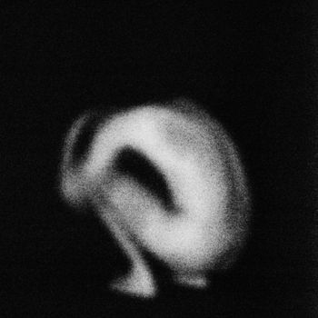 ORR - HÖR (Explicit)