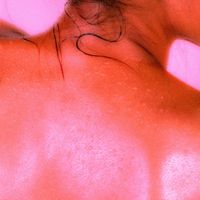 PATRICK - poate daca stai