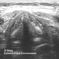 Si Begg - Extreme Vocal Environments