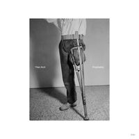 Titan Arch - Prosthetics