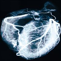 Pause - Doldur Ciğerlerime (Explicit)