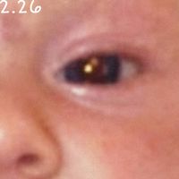 Stage P - 2.26, Pt. 2 (Explicit)