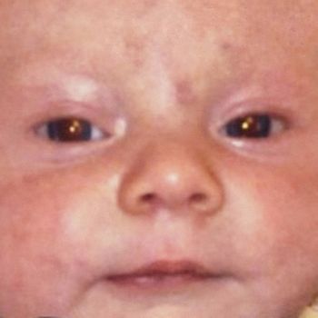 Stage P - Myself 1 (Explicit)