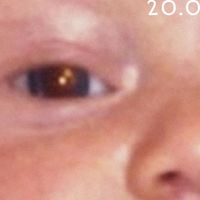 Stage P - 20.0, Pt. 1 (Explicit)