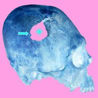 DJ Headwound - HYPNAGOGIC STATES